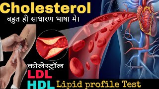 Cholesterol lipid profile testLDLHDL in Hindiby DOCTORLab [upl. by Abijah]