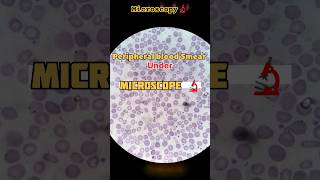 Peripheral blood Smear under Microscope 🔬 viralvideo medical youtubeshorts youtube creator lab [upl. by Edris]