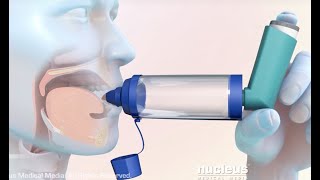 How to Use a Metered Dose Inhaler with a Spacer [upl. by Selrhc]