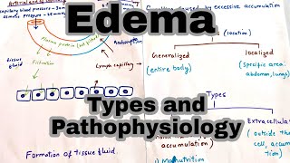 EdemaOedema  Types and its Pathophysiology [upl. by Hewart]