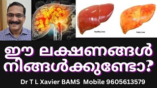 കരൾ രോഗങ്ങൾ  Dr Xavier Reveals Ayurvedic SECRETS for Liver Health [upl. by Now]