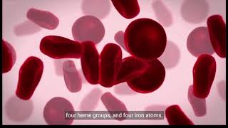 Chapter 2 Hemoglobin Electrophoresis explain [upl. by Dnaletak]