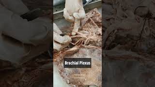 Brachial plexus 1  Anatomy Upper Limb  mbbs neet viral shorts [upl. by Ginevra27]