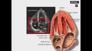 Echocardiography Introduction [upl. by Bradney]