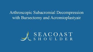 Arthroscopic Subacromial Decompression with Bursectomy and Acromioplasty [upl. by Loleta30]