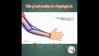 💉 HOW TO USE ADRENALINE EPINEPHRINE IN ANAPHYLAXIS  pediatrics medicine epinephrine [upl. by Asert]