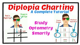 Diplopia Charting  A Complete Tutorial [upl. by Notffilc]