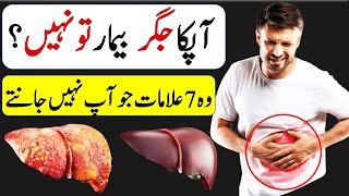 Jigar Ki Kharabi Ki Alamat  Jigar Kharab Hone Ki 7 Alamat  7 Early Signs Of Liver Failure In Urdu [upl. by Anemolihp]