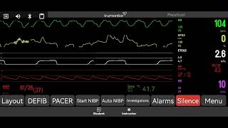 Pulseless Electrical Activity [upl. by Floria]