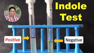 Bacterial Identification Tests Indole Test [upl. by Pammie]