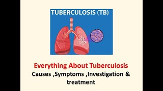 Everything about Tuberculosis l Causes l symptoms investigation l Treatment l bams bamslectures [upl. by Claire]