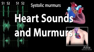 Heart Sounds and Heart Murmurs Animation [upl. by Eirahcaz]