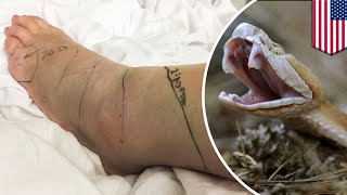 Copperhead snake Woman bitten by venomous snake inside Longhorn Steakhouse in Virginia  TomoNews [upl. by Anayia]