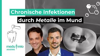 Chronische Infektionen durch Metalle im Mundraum 🦷 Dr med dent Holger Scholz [upl. by Curran463]