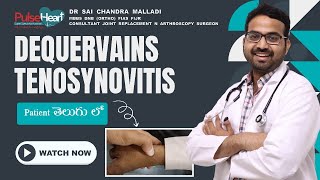 Dequervains Tenosynovitis Patient తెలుగు లో [upl. by Aralk]