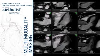 Stress MRI Methodology Current Role and Case Studies Eric Y Yang MD PhD October 23 2018 [upl. by Netsuj]