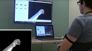 Virtual Reality Brings Pain Relief to Amputees [upl. by Frentz]