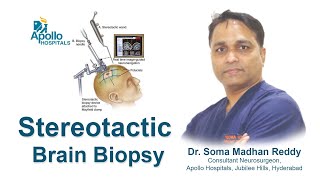 Stereotactic Brain Biopsy  Dr S Madhan Reddy Consultant Neurosurgeon  Apollo Hospitals Hyderabad [upl. by Rtoip]