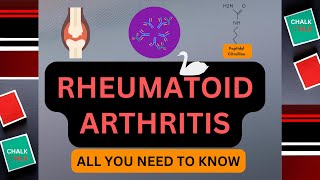 RHEUMATOID ARTHRITIS ALL YOU NEED TO KNOW [upl. by Valley]