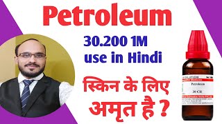 PETROLEUM 302001M Use in hindi  Petroleum 30 use  Petrolium Pomeopathic Medicine [upl. by Aiket]