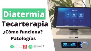 ¿Qué es la tecarterapia Patologías indicadas ✅ Diatermia Madrid Clínicas H3 [upl. by Jacquetta]