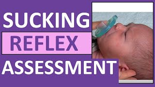 Newborn Sucking Reflex in Infant  Pediatric Nursing Assessment Exam Skill [upl. by Rehpinej385]