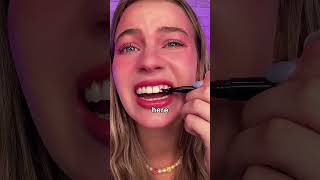 THIS TREND MADE ME LOSE MY TEETH⁉️ shocking results [upl. by Zerelda]