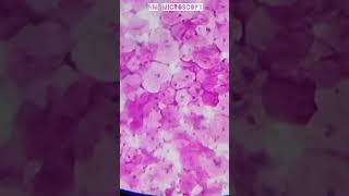 Squamous epithelial cells microscope slide🔬shortvideo youtube [upl. by Kapeed]