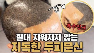 책임질 수 있는곳에서 작업받으세요 여러분두피문신 정말 좋은 기법인데 이렇게 쓰다니진짜 너무하네 [upl. by Minerva]