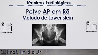 Pelve Bacia em Rã  método de Lowenstein [upl. by Ramburt623]