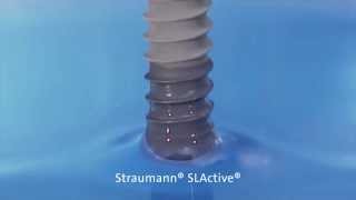 Straumann SLActive® SurfaceTest [upl. by Benilda]