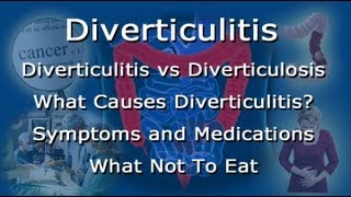 Diverticulitis Vs Diverticulosis  What To Eat What Not To Eat With Diverticulitis [upl. by Tat444]