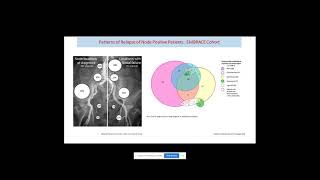 Stretching Therapeutic Horizon in Primary and Recurrent Ca CervixProf Supriya ChopraTMH Mumbai [upl. by Novets]