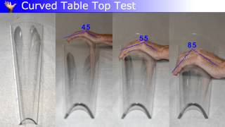 Measurement of Dupuytren Disease [upl. by Naitsirt320]