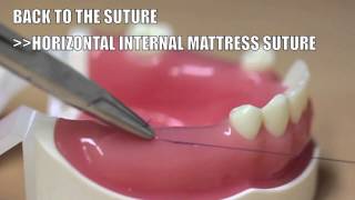 Back to the suture   3 Horizontal internal mattress suture [upl. by Evalyn412]