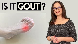 082 Gout  Everything You Need to Know [upl. by Hebner762]