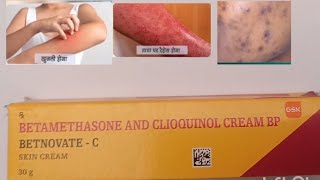 Betnovate C Cream Use Betnovate c cream review Composition Price and Side Effects in Hindi [upl. by Suiramed30]