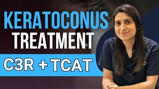 Treatment Of Keratoconus C3R TCAT C3R [upl. by Skipp]