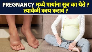 Pregnancy मध्ये पायांना सूज का येते   How to Reduce Swelling During Pregnancy  Lokmat Sakhi  RI3 [upl. by Ettenotna]