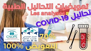 ✅ CNOPS CNSS تعويضات التحاليل الطبية [upl. by Spillar]