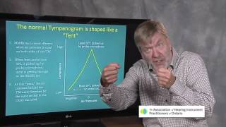 Ted Venema Talks Tympanometry [upl. by Vanny977]