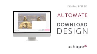 3Shape Automate – Downloading your design [upl. by Attolrac]