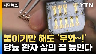 자막뉴스 피부에 붙이기만 하세요당뇨 환자에 희소식  YTN [upl. by Aihtela]