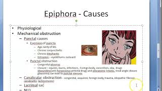 Ophthalmology 399 a Epiphora [upl. by Chere922]