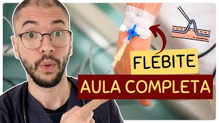 O QUE É FLEBITE E COMO IDENTIFICAR  AULA COMPLETA [upl. by Trula]