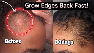 How To REGROW Edges On Natural Hair FAST amp EASYTips for hair loss amp repair [upl. by Eltsyek]