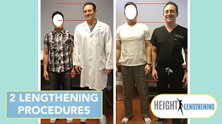 Recovering from a Double Limb Lengthening Procedure  Height Lengthening [upl. by Jasik]