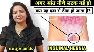 क्या दवाओं से हर्निया का इलाज संभव है  Treatment of Inguinal Hernia  Inguinal hernia [upl. by Jenni905]