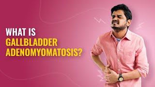 Gallbladder Adenomyomatosis Symptoms Causes and Treatment Explained  MFine [upl. by Vashtee757]