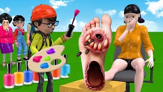 Scary Teacher 3D vs Squid Game Feet Treatment or Error 5 Time Challenge [upl. by Dowling]